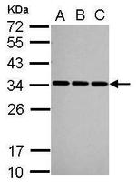 SNRPA Antibody in Western Blot (WB)