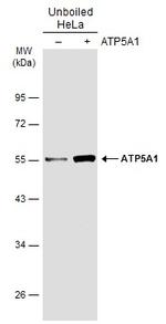 ATP5A1 Antibody in Western Blot (WB)