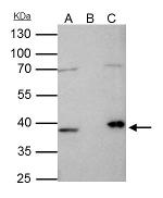 Fibrillarin Antibody in Immunoprecipitation (IP)