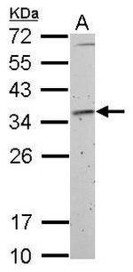 Fibrillarin Antibody in Western Blot (WB)