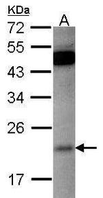 RAP1B Antibody in Western Blot (WB)