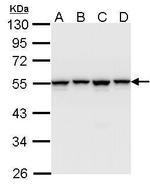 hnRNP H1 Antibody in Western Blot (WB)