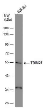 TRIM27 Antibody in Western Blot (WB)
