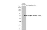 NGFR Antibody in Western Blot (WB)