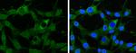 GABBR1 Antibody in Immunocytochemistry (ICC/IF)