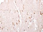 GABBR1 Antibody in Immunohistochemistry (Paraffin) (IHC (P))