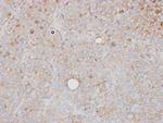 PRPS1 Antibody in Immunohistochemistry (Paraffin) (IHC (P))