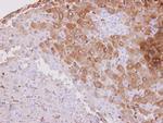 HSD3B2 Antibody in Immunohistochemistry (Paraffin) (IHC (P))