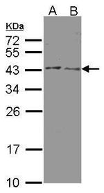 HSD3B2 Antibody in Western Blot (WB)