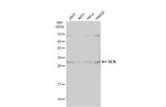 DCK Antibody in Western Blot (WB)