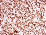 TAF15 Antibody in Immunohistochemistry (Paraffin) (IHC (P))