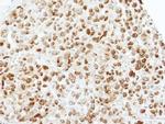 TAF15 Antibody in Immunohistochemistry (Paraffin) (IHC (P))