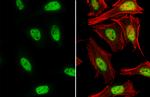 Nrf2 Antibody in Immunocytochemistry (ICC/IF)