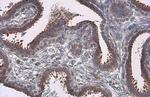 Nrf2 Antibody in Immunohistochemistry (Paraffin) (IHC (P))