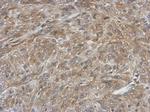 FDXR Antibody in Immunohistochemistry (Paraffin) (IHC (P))