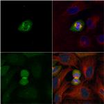 PLK1 Antibody in Immunocytochemistry (ICC/IF)