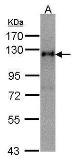 TIMELESS Antibody in Western Blot (WB)