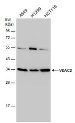 VDAC2 Antibody in Western Blot (WB)