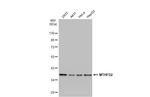 MTHFD2 Antibody in Western Blot (WB)