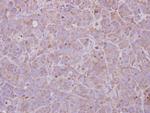 MAGEB1 Antibody in Immunohistochemistry (Paraffin) (IHC (P))