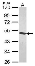 MAGEB1 Antibody in Western Blot (WB)