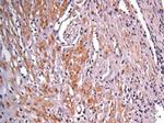 IDH1 Antibody in Immunohistochemistry (Paraffin) (IHC (P))