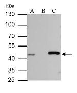 IDH1 Antibody in Immunoprecipitation (IP)