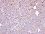 STS Antibody in Immunohistochemistry (Paraffin) (IHC (P))