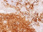 GBP1 Antibody in Immunohistochemistry (Paraffin) (IHC (P))