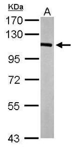 Catenin alpha-1 Antibody in Western Blot (WB)