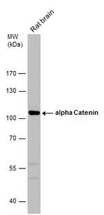 Catenin alpha-1 Antibody in Western Blot (WB)