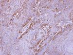 SIRT3 Antibody in Immunohistochemistry (Paraffin) (IHC (P))