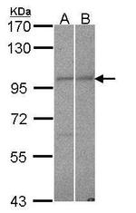 RANBP9 Antibody in Western Blot (WB)