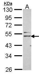 Nogo Receptor Antibody in Western Blot (WB)