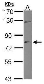 TIGD1 Antibody in Western Blot (WB)