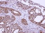 CK2 alpha-1 Antibody in Immunohistochemistry (Paraffin) (IHC (P))