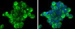 Zap-70 Antibody in Immunocytochemistry (ICC/IF)