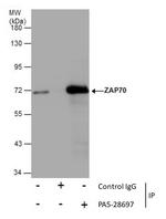 Zap-70 Antibody in Immunoprecipitation (IP)