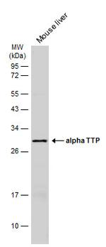 alpha TTP Antibody in Western Blot (WB)