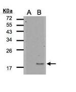 IL1F5 Antibody in Western Blot (WB)