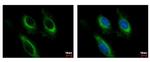 CD122 Antibody in Immunocytochemistry (ICC/IF)