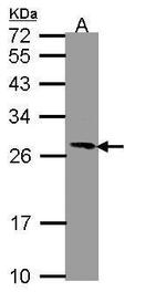 PGRMC1 Antibody in Western Blot (WB)