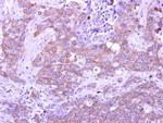 GIMAP5 Antibody in Immunohistochemistry (Paraffin) (IHC (P))