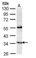 GIMAP5 Antibody in Western Blot (WB)