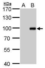 KLF10 Antibody in Western Blot (WB)