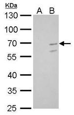 KLF10 Antibody in Western Blot (WB)