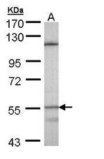 CYP4B1 Antibody in Western Blot (WB)