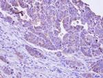 MKP4 Antibody in Immunohistochemistry (Paraffin) (IHC (P))