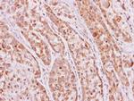 KHK Antibody in Immunohistochemistry (Paraffin) (IHC (P))