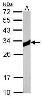 KHK Antibody in Western Blot (WB)